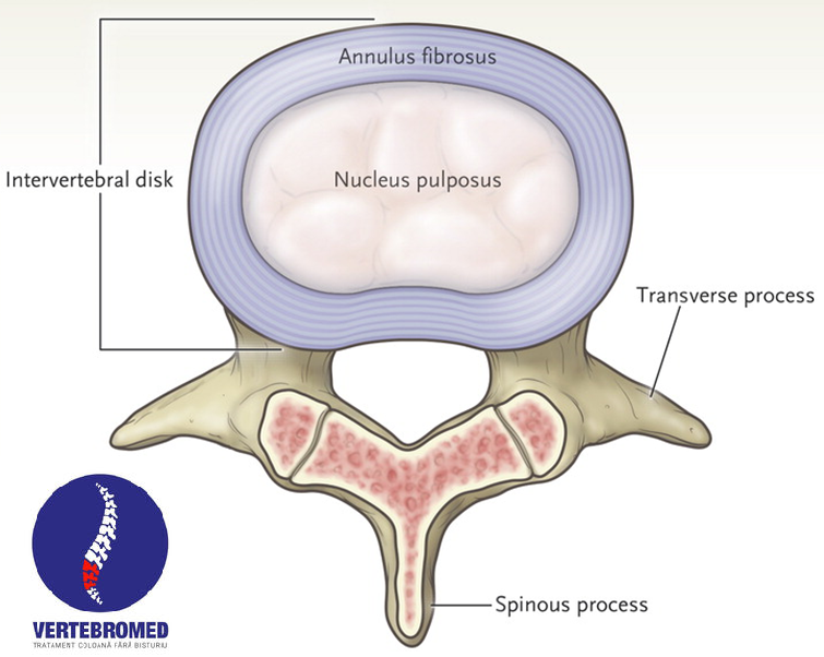 Disc intervertebral - Wikipedia